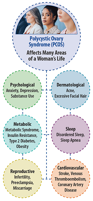 Polycystic Ovary Syndrome (PCOS) affects many areas of a woman's life including, psychological, dermatological, metabolic, sleep, reproductive, and cardiovascular effects