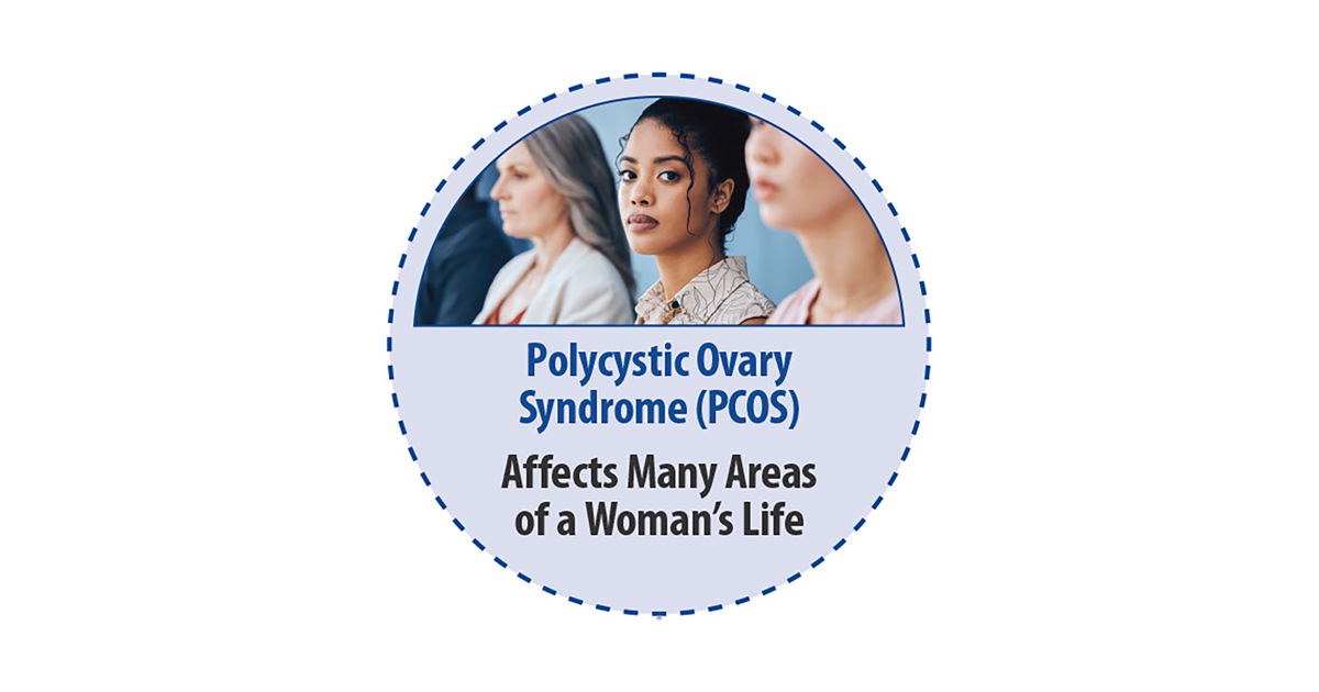 AI and Machine Learning Can Successfully Diagnose Polycystic Ovary Syndrome, New Study Confirms