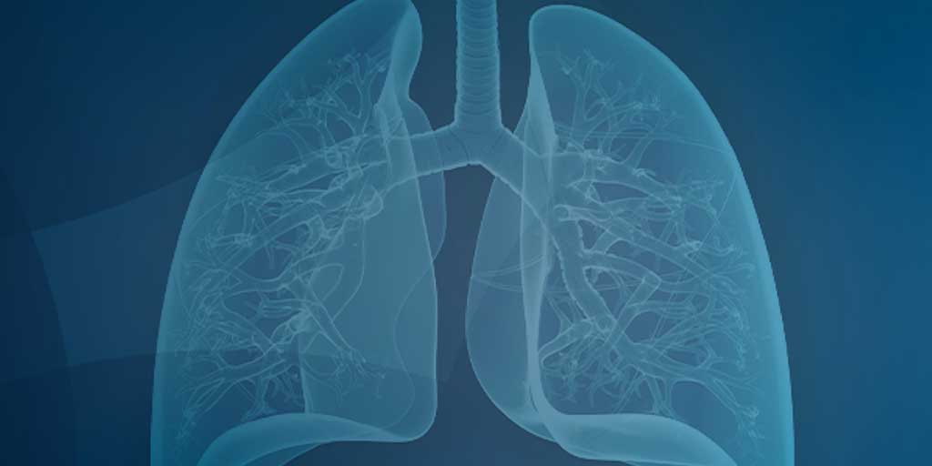 NIH Statement on World Asthma Day 2019