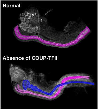 Normal embryos versus Absence of COUP-TFII embryos
