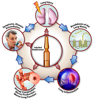 graphic displaying the relationships between inhaled hyaluronan and lung injuries