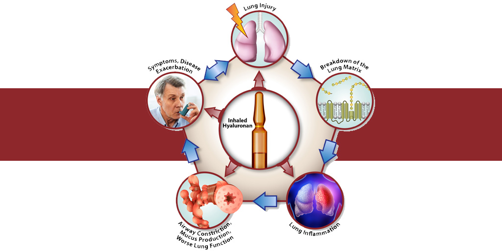 NIH Study Shows Hyaluronan Is Effective in Treating Chronic Lung Disease