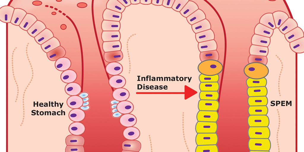 Male Hormones Regulate Stomach Inflammation in Mice