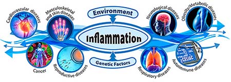 Environment and Genetic Factors influencing Inflammation