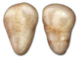 Clitoral Glands thumb