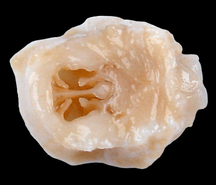 L1 anterior nasal cavity section