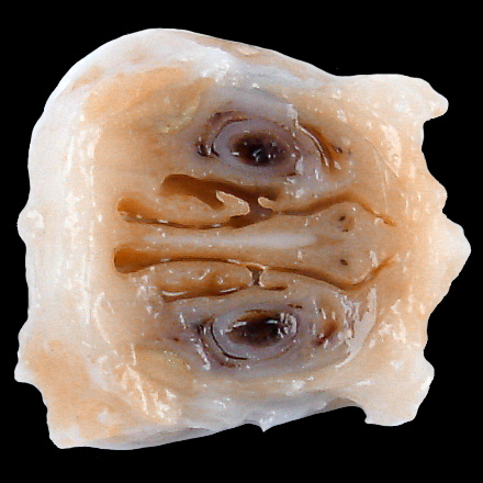 L2 anterior nasal cavity section