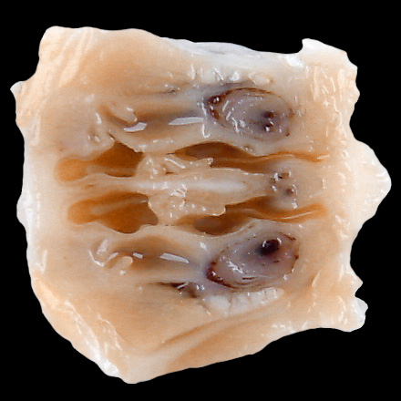 L2 Posterior Nasal Cavity Section