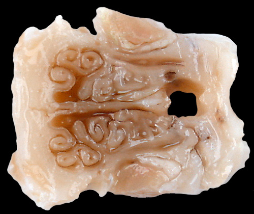 L3 anterior nasal cavity section