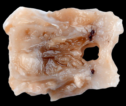 L3 posterior nasal cavity section
