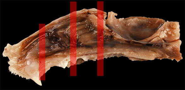 Nasal Cavity Sections