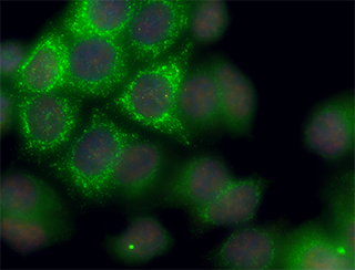 Imaging of transcription in live cells