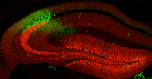 Mouse hippocampal neurons labeled with green or red fluorescent proteins can be used to study specific populations of pyramidal cells.  Here neurons in area CA2 appear green and CA3 pyramidal cells and dentate gyrus granule cells red.