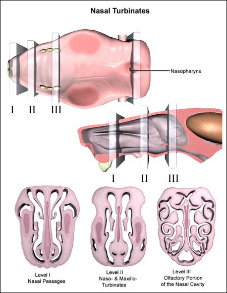 Nasal Turbinates trimming examples