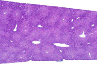 Hepatocyte Hypertrophy