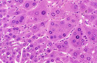 Multinucleated Hepatocytes