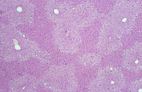 glycogen deposition in mouse liver