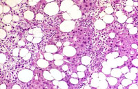 Ito cell proliferation