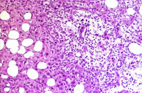 Ito cell proliferation