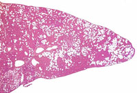 Ito cell proliferation