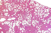 Ito cell proliferation