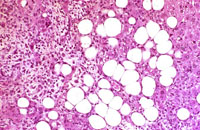 Ito cell proliferation