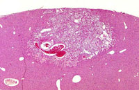 Ito cell proliferation