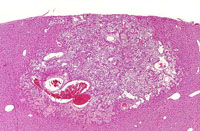 Ito cell proliferation