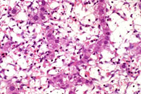 Ito cell proliferation