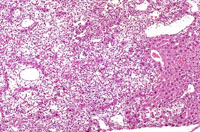 Ito cell proliferation