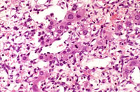 Ito cell proliferation