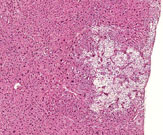 Ito cell proliferation