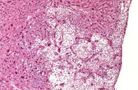 Ito cell proliferation