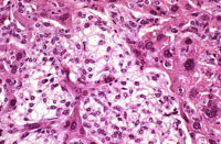 Ito cell proliferation