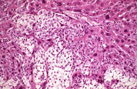 Ito cell proliferation