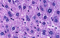 Polyploidy in the Aged Mouse Liver