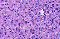 Polyploidy in the Aged Mouse Liver