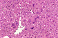 Multinucleated Hepatocytes