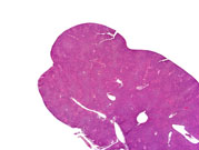 Low magnification of a hepatodiaphragmatic nodule in a mouse.