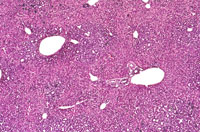 Dual Transgenic Mouse Liver