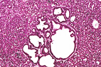 Dual Transgenic Mouse Liver