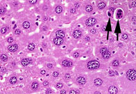 TGF alpha Transgenic Mouse Liver