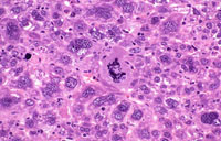 Dual Transgenic Mouse Liver