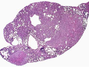 Dual Transgenic Mouse Liver