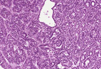 Dual Transgenic Mouse Liver