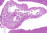 Normal Gallbladder