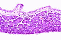 Ectopic pancreatic acinar tissue