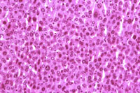 hepatocyte atrophy in mouse liver