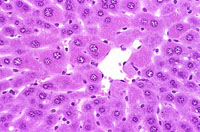 hyaline change