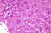 Hepatocyte Hypertrophy